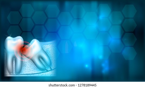 Wisdom tooth eruption problems illustrated anatomy on an abstract blue background