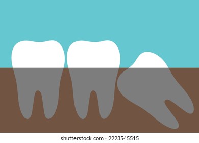 Wisdom tooth flat icon in minimalistic style. Impacted tooth