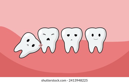 Wisdom tooth illustration: detailed depiction of the back teeth, illustrating growth and potential oral health issues