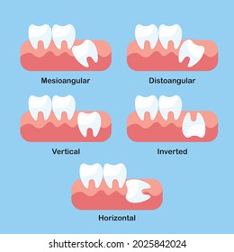 Wisdom Tooth Impaction Problems Icon Set