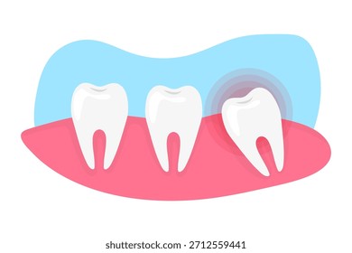 Wisdom Tooth pain and inflammation. Need of tooth extraction.