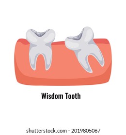 Wisdom tooth poster in flat style vector illustration