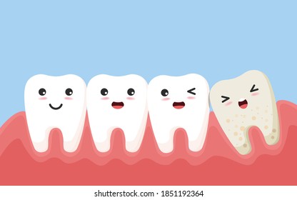 El diente sano empuja otro diente. Carácter dental de sabiduría impactada empujando dientes adyacentes causando inflamación, dolor de dientes, dolor de encías.vector, ilustración