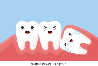 Wisdom tooth push other tooth. Impacted wisdom tooth character pushing adjacent teeth causing inflammation, toothache, gum pain.vector, illustration