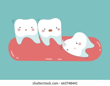 Wisdom tooth push other tooth ,teeth and tooth concept of dental 