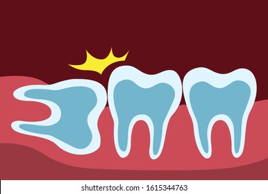 Wisdom tooth pushing adjacent teeth, wisdom tooth problem. teeth row and gum in x-ray  cartoon flat illustration vector