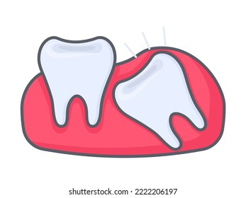 Wisdom tooth pushing another tooth, teeth and dentistry tooth concept in flat style isolated on white background. Vector illustration of problematic wisdom tooth eruption.