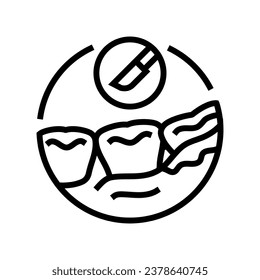 wisdom tooth removal line icon vector. wisdom tooth removal sign. isolated contour symbol black illustration