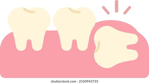 wisdom tooth removal remove discomfort pain oral dental care health