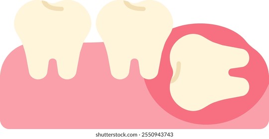 wisdom tooth removal remove discomfort pain oral dental care health