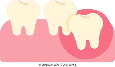 wisdom tooth removal remove discomfort pain oral dental care health