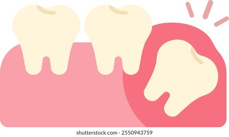 wisdom tooth removal remove discomfort pain oral dental care health