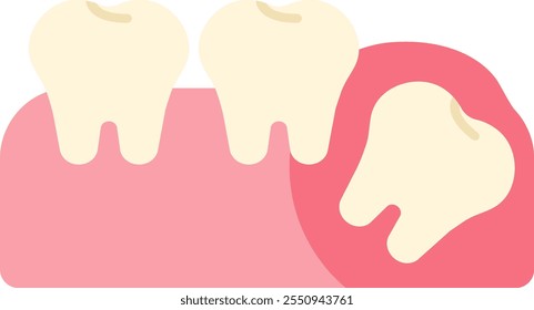 wisdom tooth removal remove discomfort pain oral dental care health