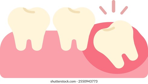 wisdom tooth removal remove discomfort pain oral dental care health