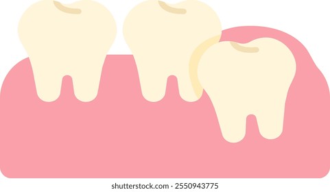 wisdom tooth removal remove discomfort pain oral dental care health