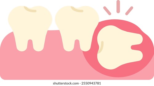 wisdom tooth removal remove discomfort pain oral dental care health