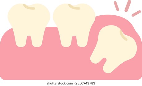 wisdom tooth removal remove discomfort pain oral dental care health