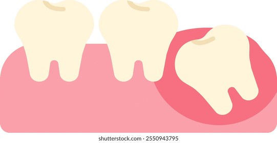 wisdom tooth removal remove discomfort pain oral dental care health