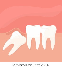 Wisdom tooth. Wisdoms teeth dental problem, gum pain, remove teeths dentist.oral health, toothache. Flat vector illustration 