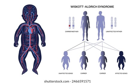 Wiskott Aldrich syndrome. X linked genetic immunodeficiency. Immune system disease in males. Child inherits one copy of a mutated gene from each parent. Affected, carriers or healthy chromosomes