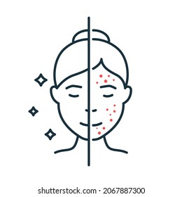 Frau mit Akne und sauberem Gesicht Hautlinie Symbol. Female Skincare für die Reinigung von Gesicht und Problem Skin Rahmensymbol. Mädchen Lineares Piktogramm vor und nach der Hautbehandlung. Einzelne Vektorgrafik.