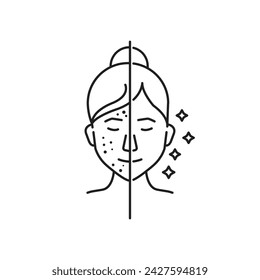 Woman with Acne and Clean Face Skin Line Icon. Female Skincare for Cleansing Face and Problem Skin Outline Icon. Girl Before and After Skin Treatment Linear Pictogram. Isolated Vector Illustration.