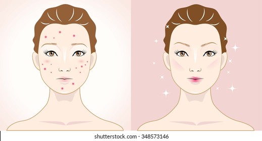 woman with acne and happy one with healthy skin.