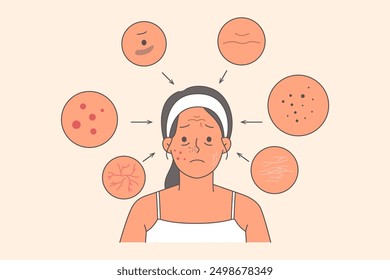 Woman with acne and wrinkles on face or cracks in dry skin needs help of cosmetologist and use of medicinal cream. Girl with problem skin is sad because of lack of cosmetics to treat blackheads