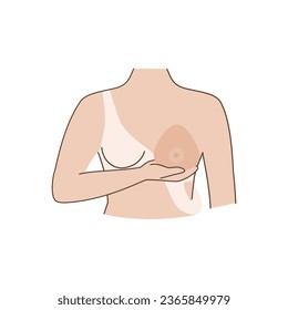 Woman after mastectomy. A girl without breasts tries on a breast prosthesis. Breast cancer. Vector illustration.