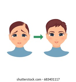 Woman with alopecia before and after hair treatment and transplantation. Female hair loss set.Before and after make over series of a balding lady. Beauty concept design. Isolated vector illustration.