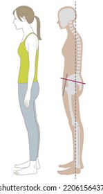 A woman with a bad posture standing flat and her skeleton