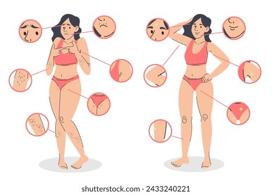 Woman before and after hair removal vector isolated. Illustration of a female person in swimwear with hair all over the body and without hair after laser depilation. Epilation procedure advertising.