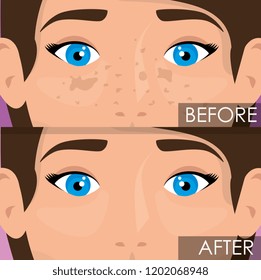 woman before and after skin treatment