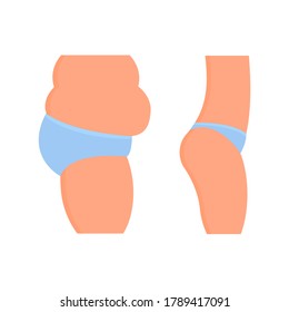 Woman belly before and after weight loss. Flat cartoon design. Side view, profile. Cellulite and sagging belly. Concept diet and healthy lifestyle. Vector illustration.