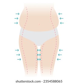 Ilustración vectorial de grasa corporal de la mujer aislada en fondo blanco. La mujer gorda vientre, cadera y muslo con flechas, líneas punteadas en la piel. Peso, liposucción, remoción de celulitis, concepto de elevación de la piel.