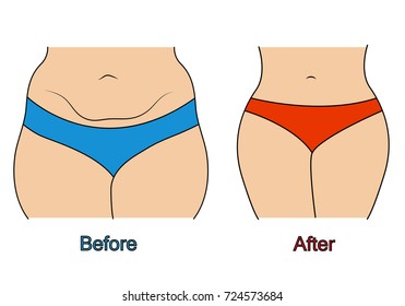 Woman body shape before and after diet or fitness
