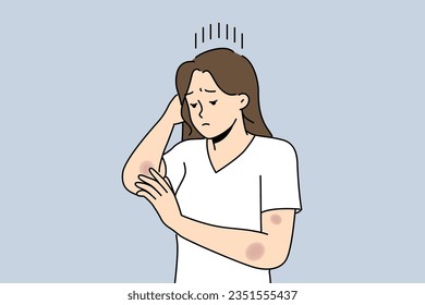 Woman with bruises on arms is sad and looks at abrasions received after fall or accident on road. Depressed girl needs healing ointment for bruises and wounds left due to domestic violence