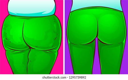 Woman buttocks, before-after. Vector illustration. 