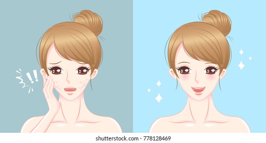 woman with cheek thin problem before and after
