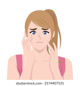 Woman Concerned About Acne and Skincare Issues holding her faces. Flat vector Character Illustration