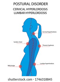 Woman contour with posture disorder in neck, chest, belly and lower back parts of a body