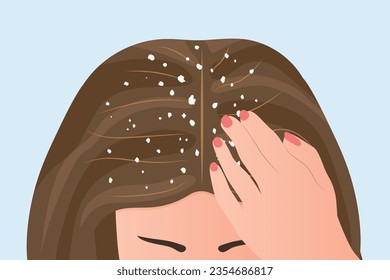 woman with dandruff on the hair- vector illustration