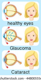 Woman with different eyes problems illustration
