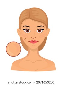 Woman different types of normal skin, enlarged area for cosmetology. Acne, wrinkles and age spots.