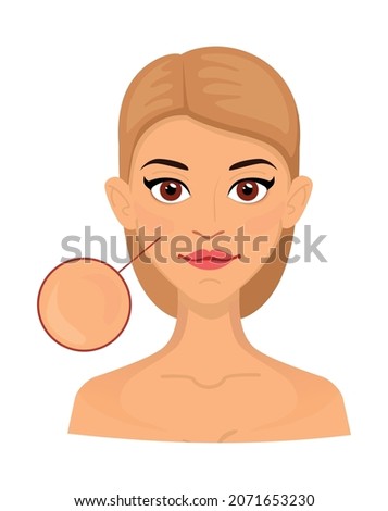 Woman different types of normal skin, enlarged area for cosmetology. Acne, wrinkles and age spots.