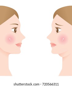 woman with double chin and beautiful slim chin. before and after