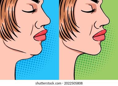 Woman double chin tightening before and after the procedure, vector illustration in pop art comics style