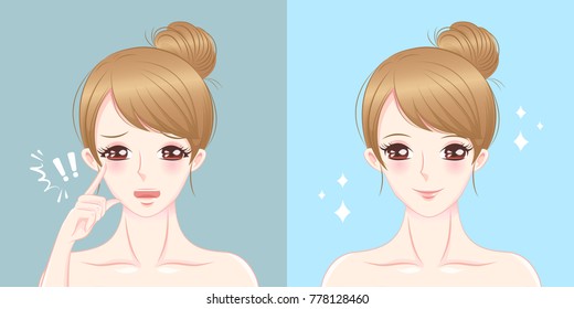 woman with drooping eye before and after