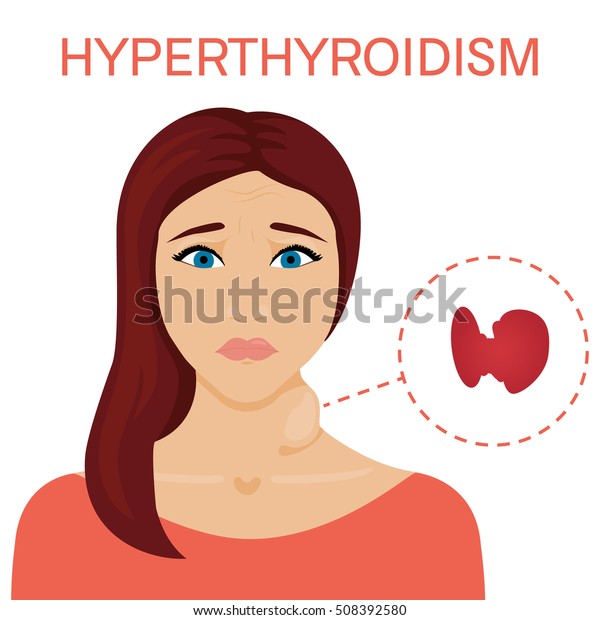 甲状腺肥大患者 甲状腺機能亢進症のシンボル 甲状腺腫患者 医療のコンセプト 人の解剖学 ベクターイラスト のベクター画像素材 ロイヤリティフリー