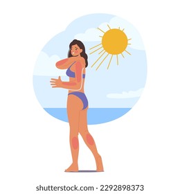 Woman Experiences Skin Sunburn On Beach Due To Excessive Sun Exposure. Skin of Female Character Appears Red And Irritated, Causing Discomfort And Pain. Cartoon People Vector Illustration